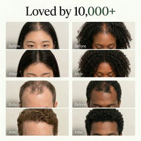 The Korean Scalp Revival Bar 5